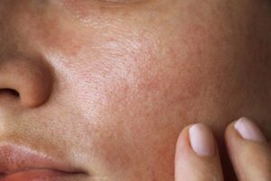 texture de la peau d'une femme au teint clair