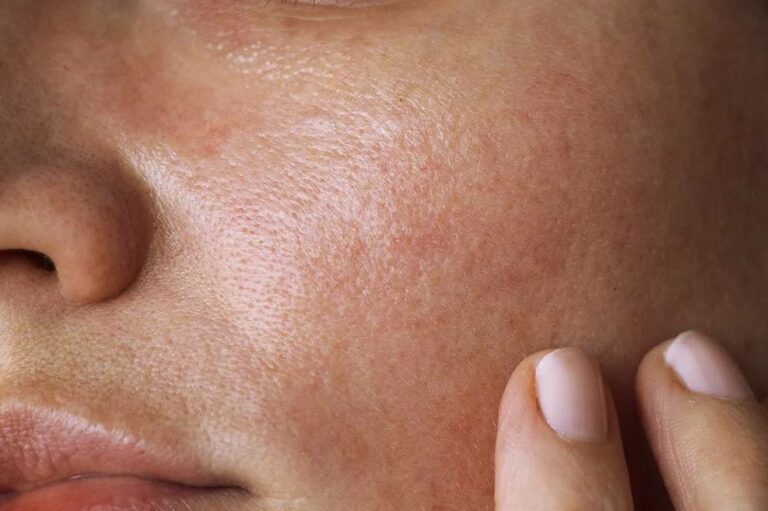 texture de la peau d'une femme au teint clair